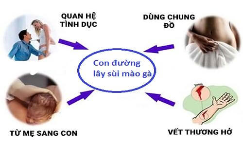 Sùi mào gà lây qua đường nào?